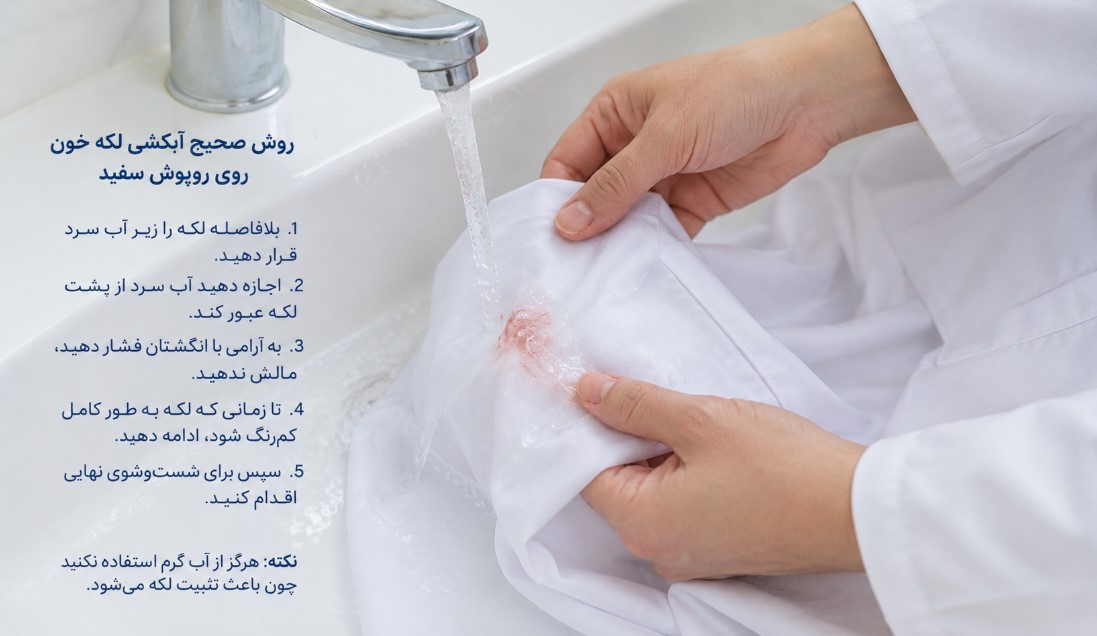 روش صحیح لکه‌بری روپوش سفید با آب سرد